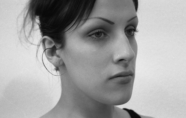 Einfache Höckernase, vor der Operation