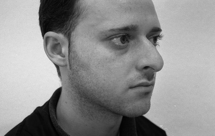 Höckernase, großbogig mit tiefer Nasenwurzel und verstichenem Übergang zur Lippe