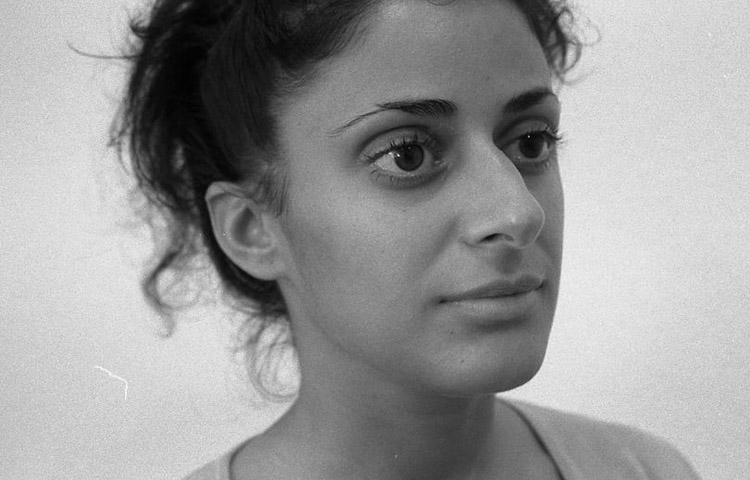 Höcker-Großnase, bei Gesichtsasymmetrie und schiefem Nasensteg. Vor der Operation.