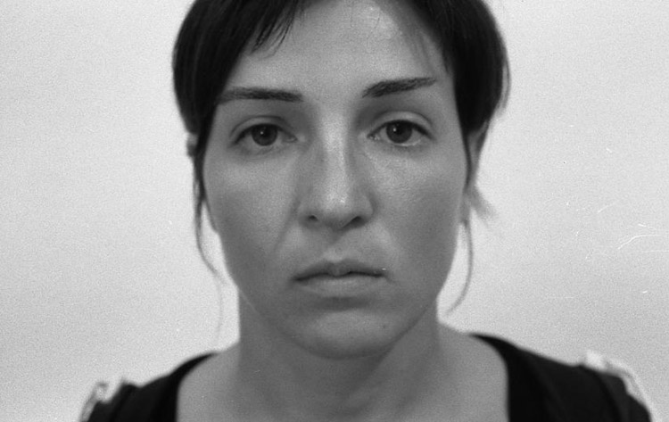 Höcker-Langnase mit kleinem Sattel und etwas zu langer Spitze. Vor der Operation.